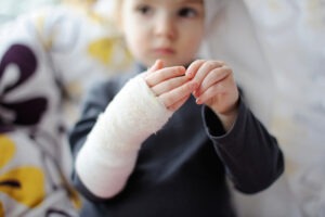 child in a cast