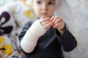 toddler girl wearing a cast