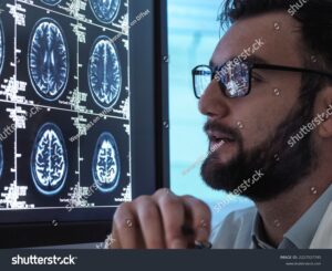 doctor reading MRI brain scan